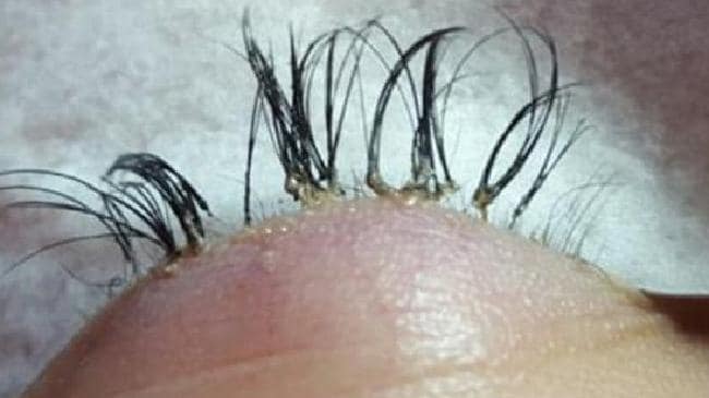 damaged eyelashes after extensions