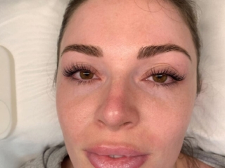Gold Coast Lash Lift
